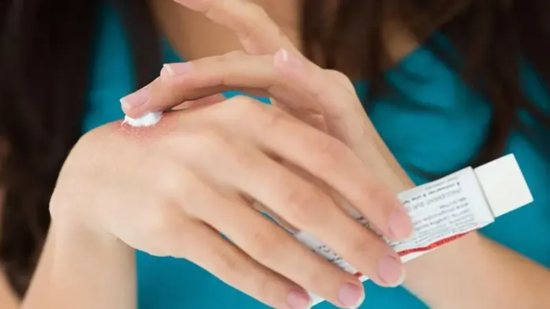 Ce terapii funcționează pentru dermatita atopică la adulți